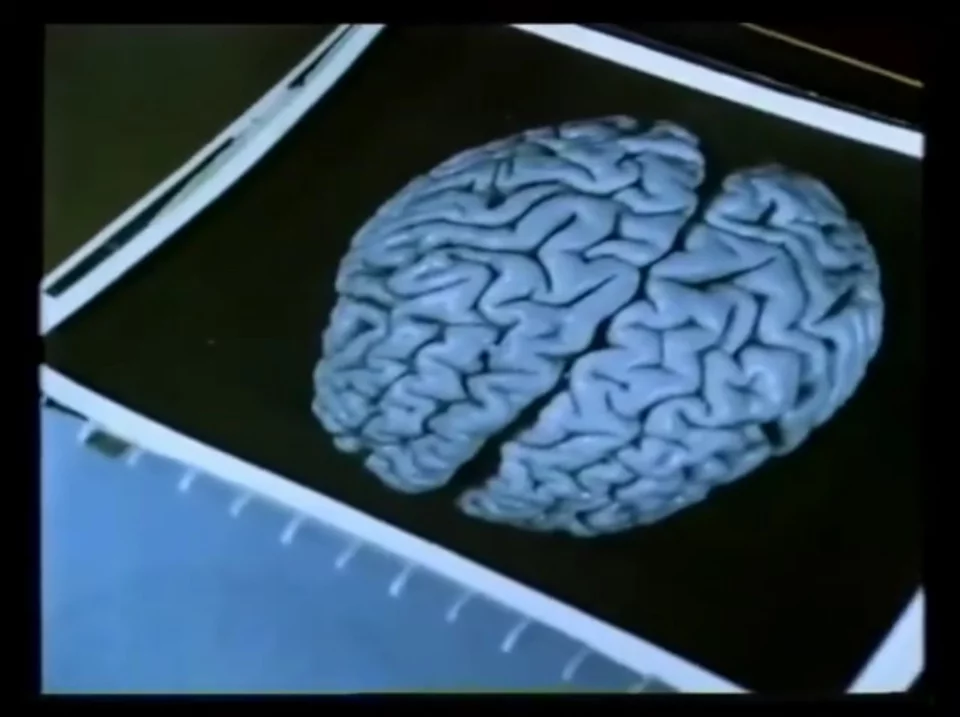 Ο εγκέφαλος του Άλμπερτ Αϊνστάιν από το αρχείο φωτογραφιών του Τόμας Χάρβεϊ